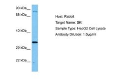 SKI Antibody, Novus Biologicals 100 &mu;L; Unconjugated:Antibodies, Polyclonal